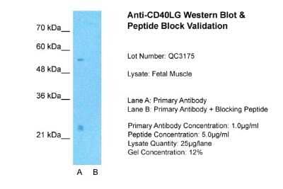 Western Blot: CD40 Ligand/TNFSF5 Antibody [NBP1-59186] - Sample Type: Human Fetal Muscle Lane A: Primary Antibody Lane B: Primary Antibody + Blocking Peptide Primary Antibody Concentration: 1 ug/ml Peptide Concentration: 5 ug/ml Lysate Quantity: 25 ug/lane/lane Gel Concentration: 0.12