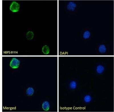 Immunocytochemistry/Immunofluorescence: CD40 Ligand/TNFSF5 Antibody (YMF323.6) [NBP2-81114] - Immunofluorescence staining of fixed human peripheral blood monocytes (PBMs) with  [NBP2-81114]. Immunofluorescence analysis of paraformaldehyde fixed human PBMs on Shi-fix coverslips, permeabilized with 0.15% Triton and stained with the chimeric rabbit IgG version of YMF323.6 [NBP2-81114] at 10 ug/ml for 1h followed by Alexa Fluor 488 secondary antibody (1 ug/ml), showing membrane staining. The nuclear stain is DAPI (blue). Panels show from left-right, top-bottom NBP2-81114, DAPI, merged channels and an isotype control. The isotype control was stained with an anti-Fluorescein antibody followed by Alexa Fluor 488 secondary antibody.