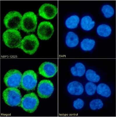 Immunocytochemistry/Immunofluorescence: CD40 Ligand/TNFSF5 Antibody (chi220) - Chimeric [NBP3-12025] - Immunofluorescence analysis of paraformaldehyde fixed Daudi cells on Shi-fix(TM) coverslips stained with the chimeric rabbit IgG version of chi220 (NBP3-12025) at 10 ug/ml for 1h followed by Alexa Fluor(R) 488 secondary antibody (2 ug/ml), showing membrane staining. The nuclear stain is DAPI (blue). Panels show from left-right, top-bottom NBP3-12025, DAPI, merged channels and an isotype control. The isotype control was an unknown specificity antibody followed by staining with Alexa Fluor(R) 488 secondary antibody.