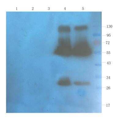 Western Blot: CD40 Ligand/TNFSF5 Antibody (hu5c8 (Ruplizumab)) [NBP2-75907] - Rat spleen (lane 1), rat muscle (lane 2), rat bladder (lane 3), human breast tumour (lane 4) and human thyroid tumour (lane 5) samples were resolved on a 10% SDS PAGE gel and blots probed with NBP2-75907 at 1 ug/ml before being detected by a secondary antibody. The expected band size (29 kDa) is seen in the human-derived samples, as well as bands corresponding to dimers and other multimers.