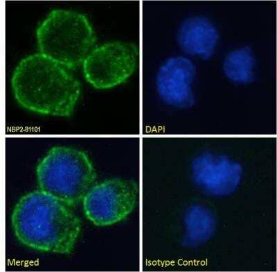 Immunocytochemistry/Immunofluorescence: CD40/TNFRSF5 Antibody (A54 scFv) [NBP2-81101] - Immunofluorescence staining of fixed Daudi cells with  [NBP2-81101]. Immunofluorescence analysis of paraformaldehyde fixed Daudi cells on Shi-fix coverslips, permeabilized with 0.15% Triton and stained with the chimeric rabbit IgG version of A54 scFv [NBP2-81101] at 10 ug/ml for 1h followed by Alexa Fluor 488 secondary antibody (1 ug/ml), showing membrane staining. The nuclear stain is DAPI (blue). Panels show from left-right, top-bottom NBP2-81101, DAPI, merged channels and an isotype control. The isotype control was stained with an anti-Fluorescein antibody followed by Alexa Fluor 488 secondary antibody.