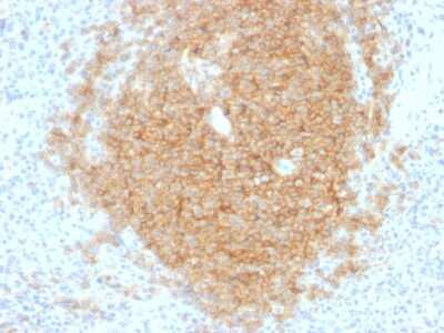 Immunohistochemistry-Paraffin: CD40/TNFRSF5 Antibody (C40/1605) [NBP2-53389] - Formalin-fixed, paraffin-embedded human Spleen stained with CD40/TNFRSF5 Antibody (C40/1605).