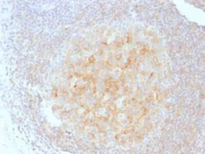 Immunohistochemistry-Paraffin: CD40/TNFRSF5 Antibody (C40/1605) [NBP2-53389] - Formalin-fixed, paraffin-embedded human Tonsil stained with CD40/TNFRSF5 Antibody (C40/1605).