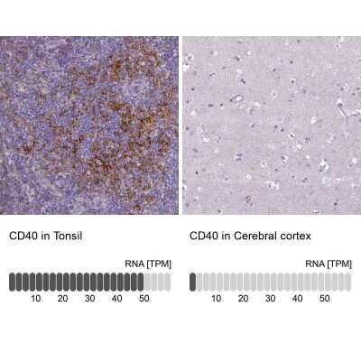 Immunohistochemistry-Paraffin: CD40/TNFRSF5 Antibody [NBP2-33956] - Analysis in human tonsil and cerebral cortex tissues. Corresponding CD40/TNFRSF5 RNA-seq data are presented for the same tissues.