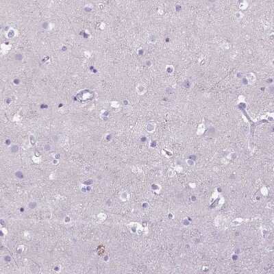 Immunohistochemistry-Paraffin: CD40/TNFRSF5 Antibody [NBP2-33956] - Staining of human cerebral cortex shows no positivity in neurons as expected.