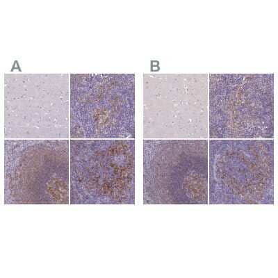 <b>Independent Antibodies Validation and Orthogonal Strategies Validation.</b>Immunohistochemistry-Paraffin: CD40/TNFRSF5 Antibody [NBP2-33956] - Staining of human cerebral cortex, lymph node, spleen and tonsil using Anti-CD40/TNFRSF5 antibody NBP2-33956 (A) shows similar protein distribution across tissues to independent antibody NBP2-33957 (B).