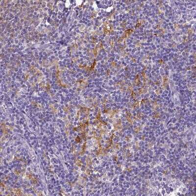 Immunohistochemistry-Paraffin: CD40/TNFRSF5 Antibody [NBP2-33956] - Staining of human lymph node shows moderate to strong membranous positivity in germinal center cells.