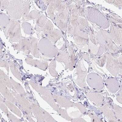 Immunohistochemistry-Paraffin: CD40/TNFRSF5 Antibody [NBP2-33956] - Staining of human skeletal muscle shows no positivity in myocytes as expected.