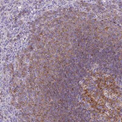 Immunohistochemistry-Paraffin: CD40/TNFRSF5 Antibody [NBP2-33956] - Staining of human spleen shows moderate membranous positivity in cells in white pulp.