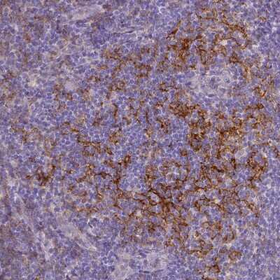 Immunohistochemistry-Paraffin: CD40/TNFRSF5 Antibody [NBP2-33956] - Staining of human tonsil shows strong membranous positivity in germinal center cells.