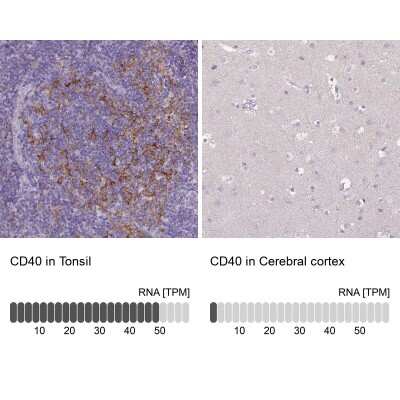 <b>Orthogonal Strategies Validation. </b>Immunohistochemistry-Paraffin: CD40/TNFRSF5 Antibody [NBP2-33957] - Analysis in human tonsil and cerebral cortex tissues. Corresponding CD40/TNFRSF5 RNA-seq data are presented for the same tissues.