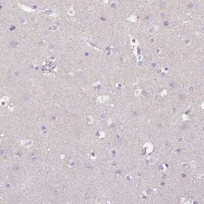 Immunohistochemistry-Paraffin: CD40/TNFRSF5 Antibody [NBP2-33957] - Staining of human cerebral cortex shows no positivity in neurons as expected.