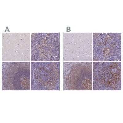 <b>Independent Antibodies Validation. </b>Immunohistochemistry-Paraffin: CD40/TNFRSF5 Antibody [NBP2-33957] - Staining of human cerebral cortex, lymph node, spleen and tonsil using Anti-CD40/TNFRSF5 antibody NBP2-33957 (A) shows similar protein distribution across tissues to independent antibody NBP2-33956 (B).