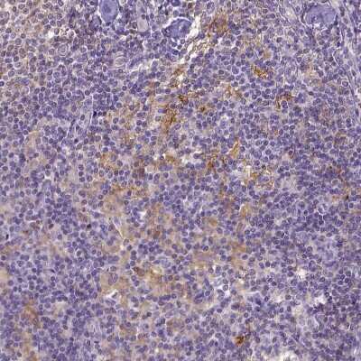 Immunohistochemistry-Paraffin: CD40/TNFRSF5 Antibody [NBP2-33957] - Staining of human lymph node shows moderate to strong membranous positivity in germinal center cells.