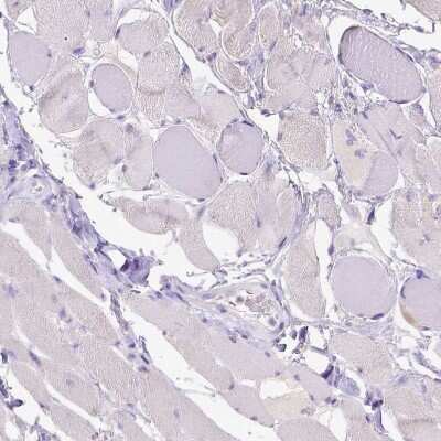 Immunohistochemistry-Paraffin: CD40/TNFRSF5 Antibody [NBP2-33957] - Staining of human skeletal muscle shows no positivity in myocytes as expected.