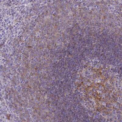 Immunohistochemistry-Paraffin: CD40/TNFRSF5 Antibody [NBP2-33957] - Staining of human spleen shows moderate membranous positivity in cells in white pulp.