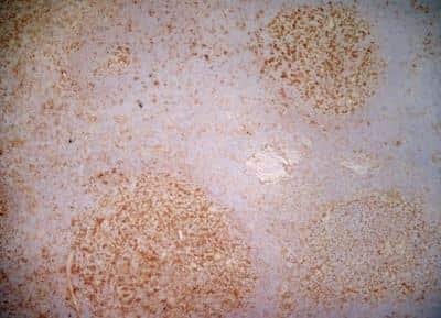 Immunohistochemistry-Frozen: CD40/TNFRSF5 Antibody (LOB7/6) [NBP1-39556] - Staining of a human tonsil cryosection with Mouse anti Human CD40 antibody, clone LOB7/6 followed by the Histar Detection system. Low power