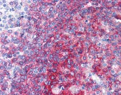Immunohistochemistry-Paraffin: CD40/TNFRSF5 Antibody (LOB7/6) [NBP1-39556] - Staining of human spleen. Immunohistochemistry of formalin-fixed, paraffin-embedded tissue after heat-induced antigen retrieval. Antibody concentration 10 ug/ml.