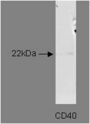 Western Blot: CD40/TNFRSF5 Antibody (T8P2G4/A6) [NBP2-50284] - Analysis of CD40 in Jurkat cell lysates.