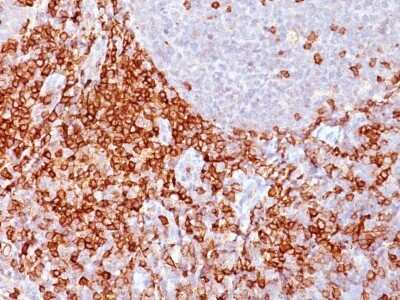 Immunohistochemistry-Paraffin: CD43/Sialophorin Antibody (Bra7G) [NBP2-44650] - Human Spleen stained with CD43 Monoclonal Antibody (Bra7G).