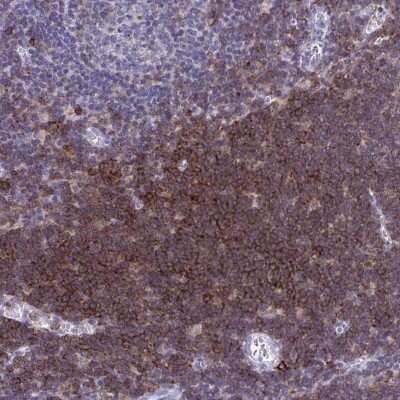 <b>Orthogonal Strategies Validation. </b>Immunohistochemistry-Paraffin: CD43/Sialophorin Antibody [NBP2-33746] - Staining of human lymph node shows high expression.