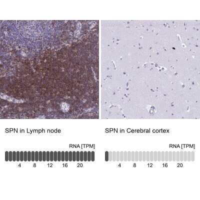 Immunohistochemistry-Paraffin: CD43/Sialophorin Antibody [NBP2-33746] - Staining in human lymph node and cerebral cortex tissues using anti-SPN antibody. Corresponding SPN RNA-seq data are presented for the same tissues.