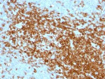 Immunohistochemistry-Paraffin: CD43/Sialophorin Antibody (SPN/1094) - IHC-Prediluted [NBP2-48394] - Formalin-fixed, paraffin-embedded human Tonsil stained with CD43 Mouse Monoclonal Antibody (SPN/1094).