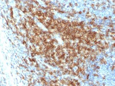 Immunohistochemistry-Paraffin: CD43/Sialophorin Antibody (SPN/2049R) - Azide and BSA Free [NBP3-08244] - Formalin-fixed, paraffin-embedded human Tonsil stained with CD43/Sialophorin Rabbit Recombinant Monoclonal Antibody (SPN/2049R).