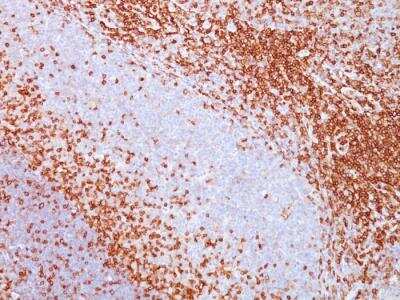 Immunohistochemistry-Paraffin: CD43/Sialophorin Antibody (SPN/839) - IHC-Prediluted [NBP2-48379] - Formalin-fixed, paraffin-embedded human spleen stained with CD43 Mouse Monoclonal Antibody (SPN/839).