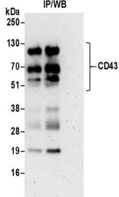 Western Blot: CD43/Sialophorin Antibody [NBP2-32115] - Whole cell lysate (0.5 or 1.0 mg per IP reaction; 20% of IP loaded) prepared using RIPA buffer from Jurkat cells.  Antibodies:  Affinity purified rabbit anti-CD43 antibody NBP2-32115 used for IP at 6 ug per reaction.  CD43 was also immunoprecipitated by rabbit anti-CD43 antibody BL16255.  For blotting immunoprecipitated CD43,NBP2-32115 was used at 1 ug/ml.  Detection: Chemiluminescence with an exposure time of 3 minutes.