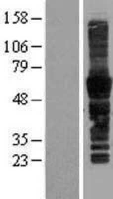 Western Blot: CD43/Sialophorin Overexpression Lysate (Adult Normal) [NBP2-10605] Left-Empty vector transfected control cell lysate (HEK293 cell lysate); Right -Over-expression Lysate for CD43/Sialophorin.