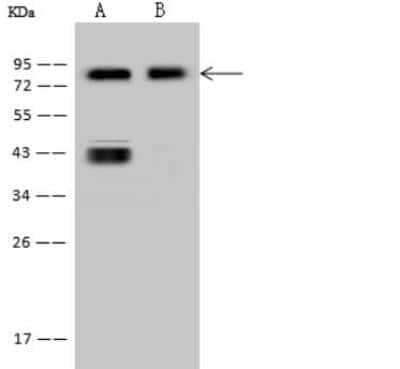 Western Blot: CD44 Antibody (065) [NBP2-90077] - Lane A: HL60 Whole Cell LysateLane B: Hela Whole Cell LysateLysates/proteins at 30 ug per lane.SecondaryGoat Anti-Mouse IgG (H+L)/HRP at 1/10000 dilution.Developed using the ECL technique.Performed under reducing conditions.Predicted band size:82 kDaObserved band size:82 kDa(We are unsure as to the identity of these extra bands.)