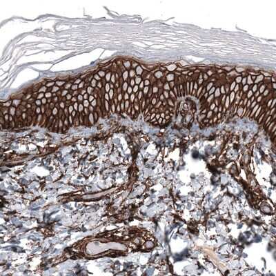 Immunohistochemistry-Paraffin: CD44 Antibody (CL13318) [NBP3-18578] - Staining of human skin shows strong membranous positivity in squamous epithelial cells.