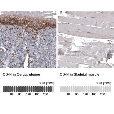 Immunohistochemistry-Paraffin: CD44 Antibody (CL13318) [NBP3-18580] - Analysis in human cervix, uterine and skeletal muscle tissues using NBP3-18580 antibody. Corresponding CD44 RNA-seq data are presented for the same tissues.