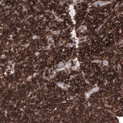 Immunohistochemistry-Paraffin: CD44 Antibody (CL13318) [NBP3-18580] - Staining of human lymph node shows strong membranous positivity in lymphoid cells.