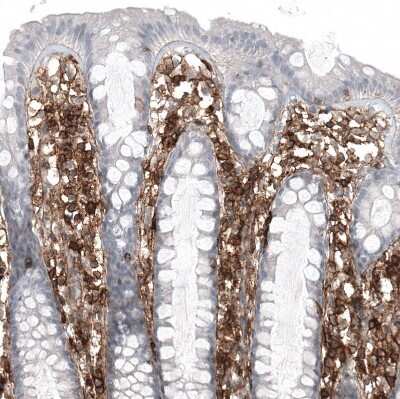 Immunohistochemistry-Paraffin: CD44 Antibody (CL13318) [NBP3-18580] - Staining of human colon shows strong membranous positivity in lymphoid cells.