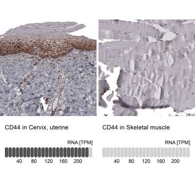 Immunohistochemistry-Paraffin: CD44 Antibody (CL13324) [NBP3-18566] - Analysis in human cervix, uterine and skeletal muscle tissues using NBP3-18566 antibody. Corresponding CD44 RNA-seq data are presented for the same tissues.