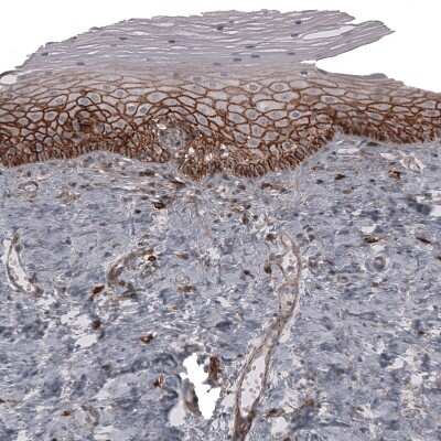 Immunohistochemistry-Paraffin: CD44 Antibody (CL13324) [NBP3-18566] - Staining of human uterine cervix shows strong membranous positivity in squamous epithelial cells.