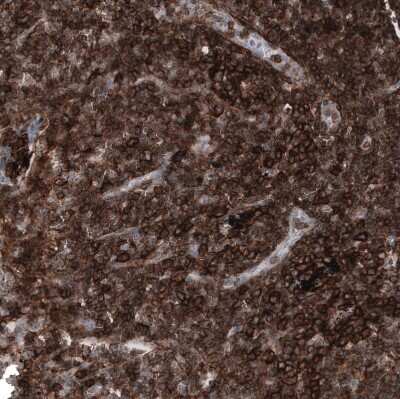 Immunohistochemistry-Paraffin: CD44 Antibody (CL13324) [NBP3-18566] - Staining of human lymph node shows strong membranous positivity in lymphoid cells.