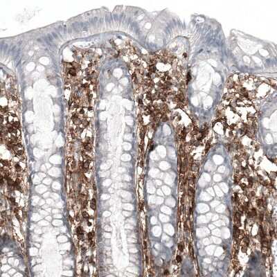 Immunohistochemistry-Paraffin: CD44 Antibody (CL13324) [NBP3-18566] - Staining of human colon shows strong membranous positivity in lymphoid cells.