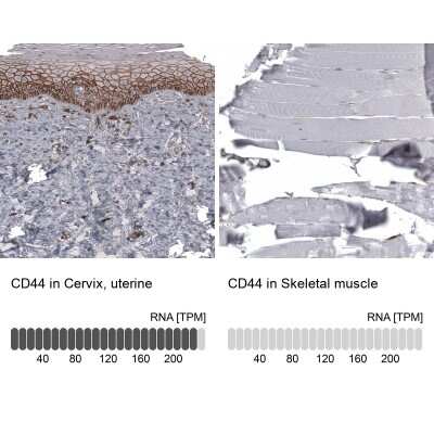 Immunohistochemistry-Paraffin: CD44 Antibody (CL13328) [NBP3-18558] - Analysis in human cervix, uterine and skeletal muscle tissues using NBP3-18558 antibody. Corresponding CD44 RNA-seq data are presented for the same tissues.