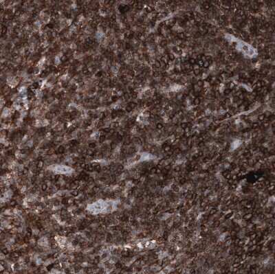 Immunohistochemistry-Paraffin: CD44 Antibody (CL13328) [NBP3-18558] - Staining of human lymph node shows strong membranous positivity in lymphoid cells.