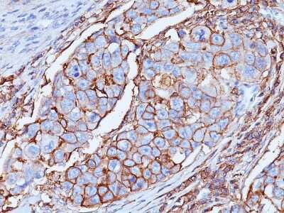 Immunohistochemistry-Paraffin: CD44 Antibody (DF1485) [NBP2-44653] - Formalin-fixed, paraffin-embedded human Breast tissue stained with CD44 Antibody (DF1485).
