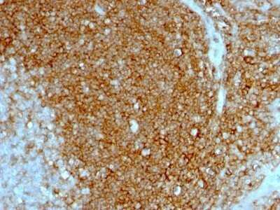 Immunohistochemistry-Paraffin: CD44 Antibody (HCAM/1097) - IHC-Prediluted [NBP2-48421] - Human Tonsil stained with CD44 Monoclonal Antibody (HCAM/1097)