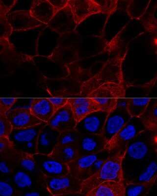 Immunocytochemistry/Immunofluorescence: CD44 Antibody [NBP2-92947] - Analysis of A431 cells using CD44 at dilution of 1:200. Blue: DAPI for nuclear staining.