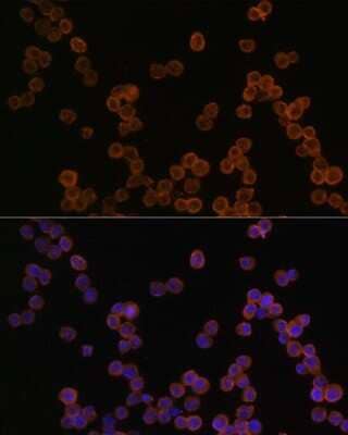 Immunocytochemistry/Immunofluorescence: CD44 Antibody [NBP2-92947] - Analysis of RAW264.7 cells using CD44 at dilution of 1:100. Blue: DAPI for nuclear staining.