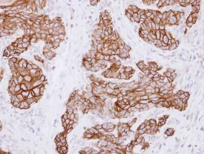 Immunohistochemistry-Paraffin: CD44 Antibody [NBP2-15809] - Immunohistochemical analysis of paraffin-embedded Cal27 xenograft , using antibody at 1:100 dilution.