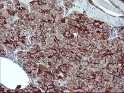 Immunohistochemistry: CD44 Antibody (OTI1E3) - Azide and BSA Free [NBP2-70379] - Analysis of Human pancreas tissue.