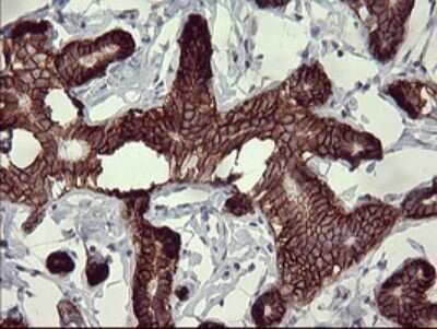 Immunohistochemistry: CD44 Antibody (OTI1E3) [NBP2-46151] - Analysis of Human breast tissue.