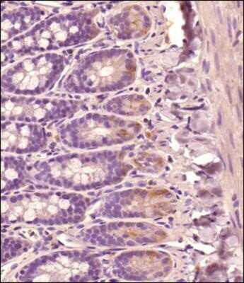 Immunocytochemistry: CD44 Antibody (OX-50) - Azide and BSA Free [NBP2-80649] - Analysis of a FFPE tissue section of Rat small intestine using Mouse anti-Rat CD44 antibody (clone OX50) at 1:100 dilution. The staining was detected using HRP-conjugated anti-Mouse secondary antibody with DAB reagent followed by hematoxylin counterstaini